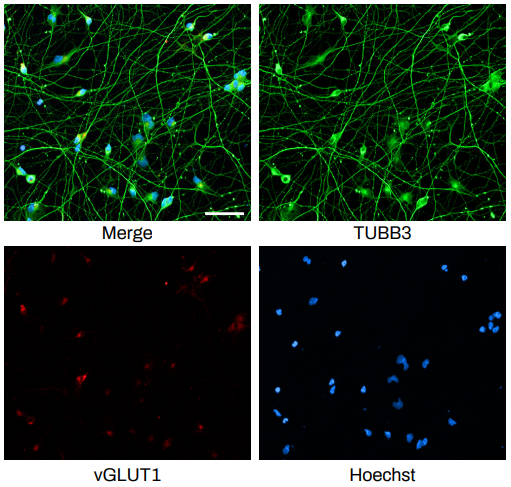 Genetic And Functional Profiling Of Hipsc Derived Excitatory Neurons Differentiated By Quick